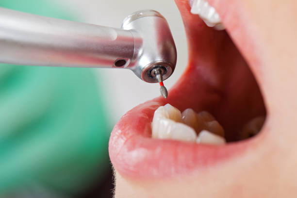 Best Urgent Care for Lost Fillings or Crowns in District Heights, MD